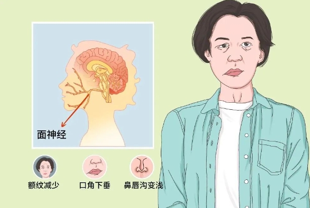 洛阳市嘴歪专科 洛阳市嘴歪专科